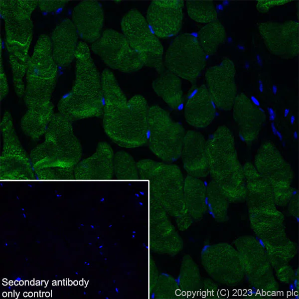 Immunohistochemistry (Frozen sections) - Anti-Nicotinic Acetylcholine Receptor alpha 1/CHRNA1 antibody [EPR27397-4] - BSA and Azide free (AB308307)