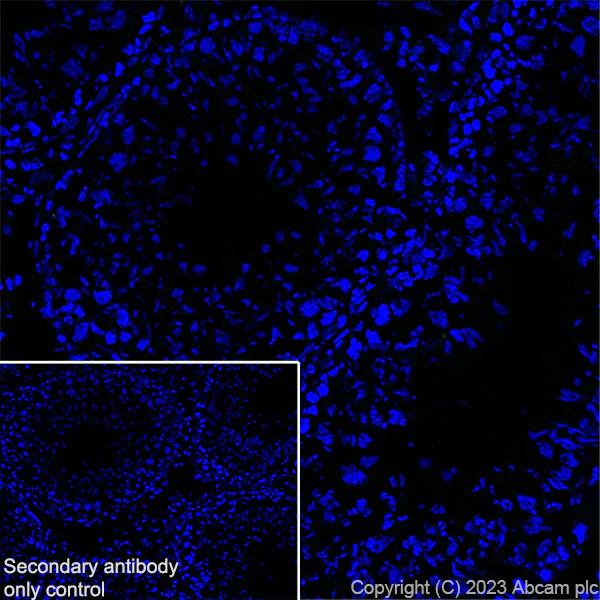 Immunohistochemistry (Frozen sections) - Anti-Nicotinic Acetylcholine Receptor alpha 1/CHRNA1 antibody [EPR27397-4] - BSA and Azide free (AB308307)