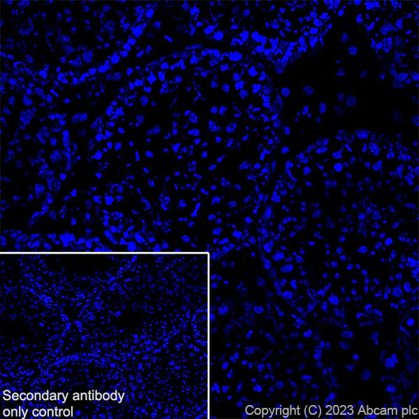 Immunohistochemistry (Frozen sections) - Anti-Nicotinic Acetylcholine Receptor alpha 1/CHRNA1 antibody [EPR27397-4] - BSA and Azide free (AB308307)