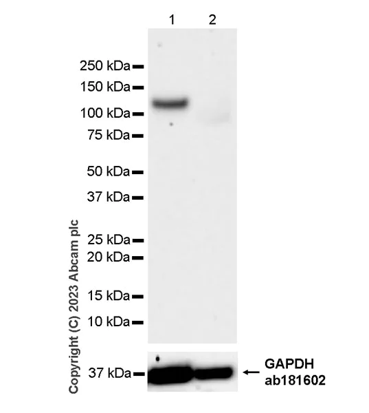 Western blot - Anti-Nicotinic Acetylcholine Receptor alpha 1/CHRNA1 antibody [EPR27397-4] - BSA and Azide free (AB308307)