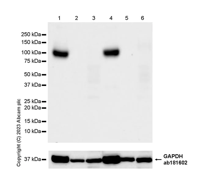 Western blot - Anti-Nicotinic Acetylcholine Receptor alpha 1/CHRNA1 antibody [EPR27397-4] - BSA and Azide free (AB308307)