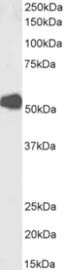 Western blot - Anti-Nicotinic Acetylcholine Receptor alpha 1/CHRNA1 antibody [mAb 192] (AB288434)