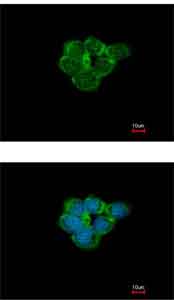 Immunocytochemistry/ Immunofluorescence - Anti-Nicotinic Acetylcholine Receptor alpha 3/CHRNA3 antibody (AB151580), expandable thumbnail