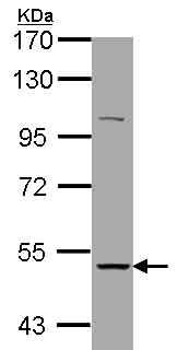 Western blot - Anti-Nicotinic Acetylcholine Receptor alpha 3/CHRNA3 antibody (AB151580), expandable thumbnail