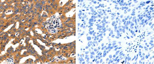 Immunohistochemistry (Formalin/PFA-fixed paraffin-embedded sections) - Anti-Nicotinic Acetylcholine Receptor alpha 3/CHRNA3 antibody (AB183097)