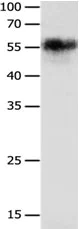 Western blot - Anti-Nicotinic Acetylcholine Receptor alpha 3/CHRNA3 antibody (AB183097)