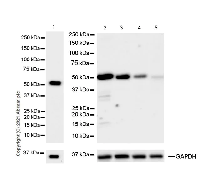 Western blot - Anti-Nicotinic Acetylcholine Receptor alpha 5/CHRNA5 antibody [EPR24135-98] (AB259859)