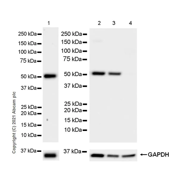Western blot - Anti-Nicotinic Acetylcholine Receptor alpha 5/CHRNA5 antibody [EPR24135-98] (AB259859)