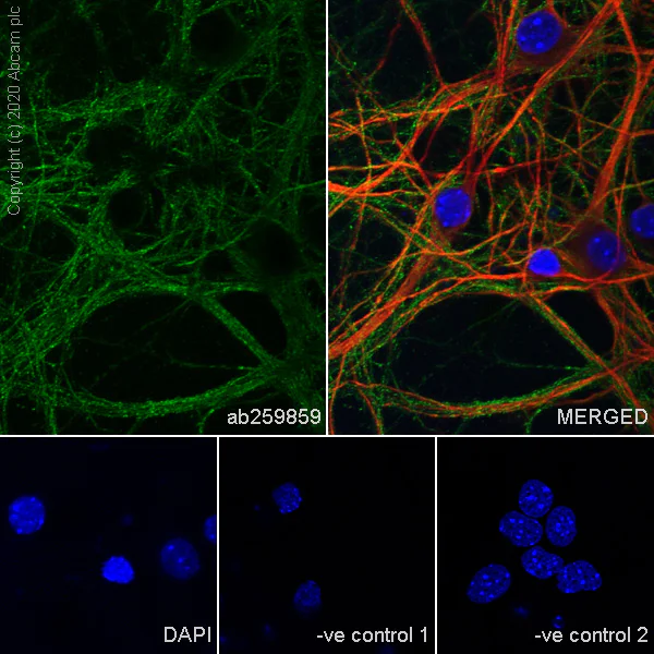 Immunocytochemistry/ Immunofluorescence - Anti-Nicotinic Acetylcholine Receptor alpha 5/CHRNA5 antibody [EPR24135-98] - BSA and Azide free (AB280367)