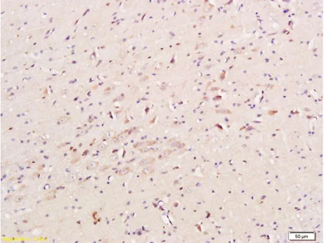 Immunohistochemistry (Formalin/PFA-fixed paraffin-embedded sections) - Anti-Nicotinic Acetylcholine Receptor alpha 7 antibody (AB216485)