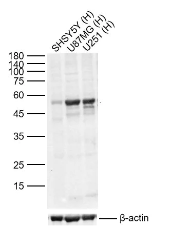 Western blot - Anti-Nicotinic Acetylcholine Receptor alpha 7 antibody (AB216485)