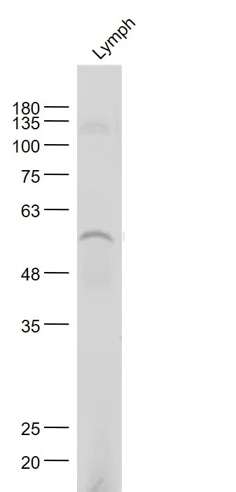 Western blot - Anti-Nicotinic Acetylcholine Receptor alpha 7 antibody (AB216485)