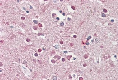 Immunohistochemistry (Formalin/PFA-fixed paraffin-embedded sections) - Anti-Nicotinic Acetylcholine Receptor beta 2/CHRNB2 antibody (AB189174)