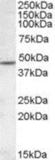 Western blot - Anti-Nicotinic Acetylcholine Receptor beta 2/CHRNB2 antibody (AB189174)