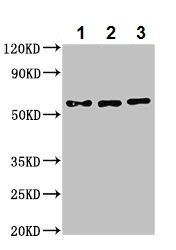 Western blot - Anti-Nicotinic Acetylcholine Receptor beta/CHRNB1 antibody (AB236959)
