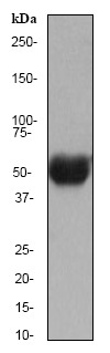 Western blot - Anti-Nicotinic Acetylcholine Receptor beta/CHRNB1 antibody [EP2067Y] (AB76159)