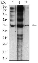 Western blot - Anti-Nicotinic Acetylcholine Receptor epsilon/CHRNE antibody [4E10F6] (AB233831)