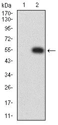 Western blot - Anti-Nicotinic Acetylcholine Receptor epsilon/CHRNE antibody [4E10F6] (AB233831)