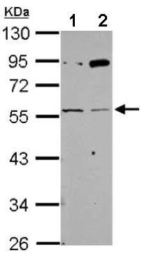 Western blot - Anti-Nicotinic Acetylcholine Receptor gamma antibody (AB151627)