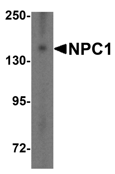 Western blot - Anti-Niemann Pick C1 antibody (AB106534)
