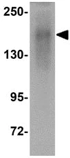 Western blot - Anti-Niemann Pick C1 antibody (AB106534)