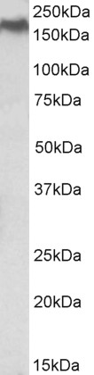 Western blot - Anti-Niemann Pick C1 antibody (AB177233), expandable thumbnail