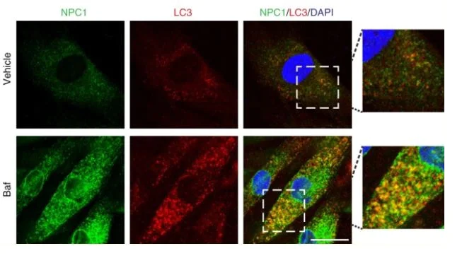 Immunocytochemistry/ Immunofluorescence - Anti-Niemann Pick C1 antibody [EPR5209] (AB134113)