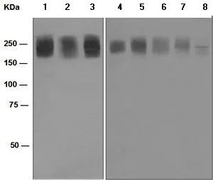 Western blot - Anti-Niemann Pick C1 antibody [EPR5209] (AB134113)