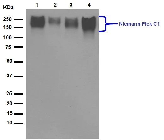 Western blot - Anti-Niemann Pick C1 antibody [EPR5209] (AB134113)