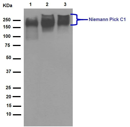 Western blot - Anti-Niemann Pick C1 antibody [EPR5209] (AB134113)
