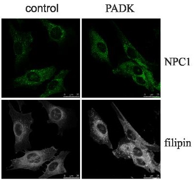Immunocytochemistry/ Immunofluorescence - Anti-Niemann Pick C1 antibody [EPR5209] - BSA and Azide free (AB224268), expandable thumbnail