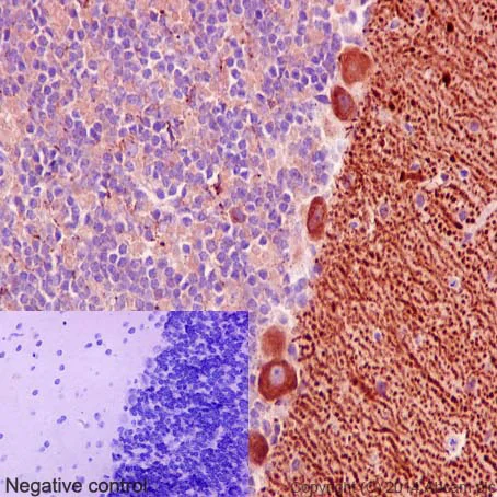 Immunohistochemistry (Formalin/PFA-fixed paraffin-embedded sections) - Anti-Niemann Pick C1 antibody [EPR5209] - BSA and Azide free (AB224268)