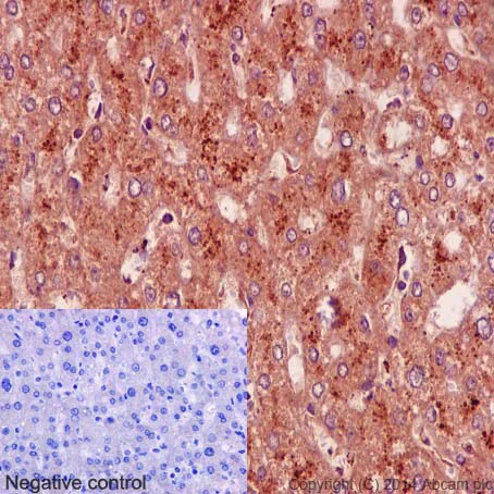 Immunohistochemistry (Formalin/PFA-fixed paraffin-embedded sections) - Anti-Niemann Pick C1 antibody [EPR5209] - BSA and Azide free (AB224268)
