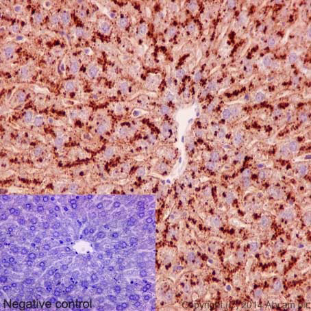Immunohistochemistry (Formalin/PFA-fixed paraffin-embedded sections) - Anti-Niemann Pick C1 antibody [EPR5209] - BSA and Azide free (ab224268), expandable thumbnail