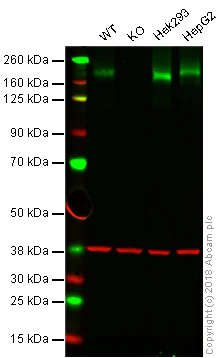 Western blot - Anti-Niemann Pick C1 antibody [EPR5209] - BSA and Azide free (AB224268)