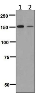 Western blot - Anti-Niemann Pick C1 Like 1/NPC1L1 antibody [EPR5717] (AB124801)