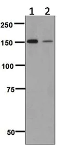 Western blot - Anti-Niemann Pick C1 Like 1/NPC1L1 antibody [EPR5717] - BSA and Azide free (AB248011)