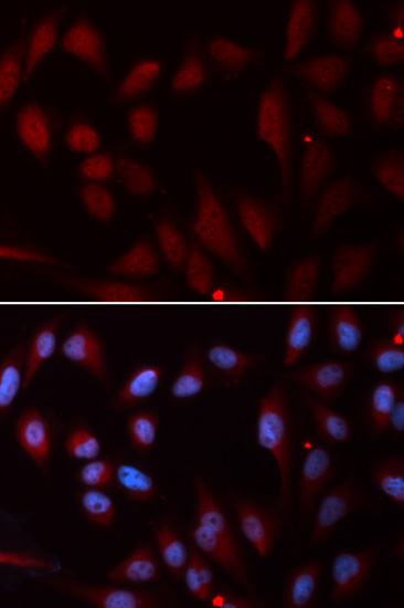 Immunocytochemistry/ Immunofluorescence - Anti-Niemann Pick C2 antibody (AB186829), expandable thumbnail