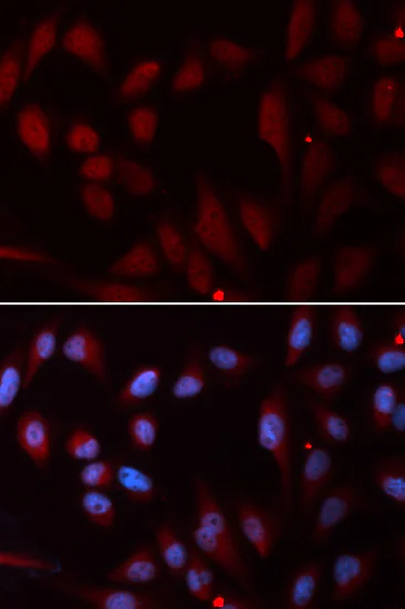 Immunocytochemistry/ Immunofluorescence - Anti-Niemann Pick C2 antibody (AB186829)