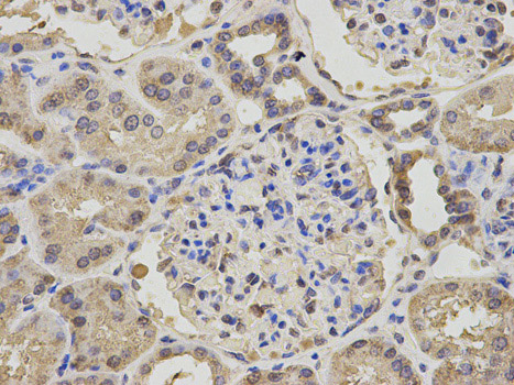 Immunohistochemistry (Formalin/PFA-fixed paraffin-embedded sections) - Anti-Niemann Pick C2 antibody (AB186829), expandable thumbnail