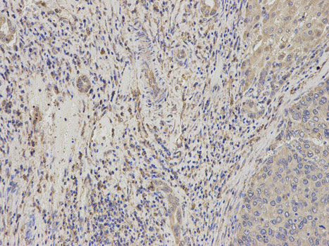 Immunohistochemistry (Formalin/PFA-fixed paraffin-embedded sections) - Anti-Niemann Pick C2 antibody (AB186829), expandable thumbnail