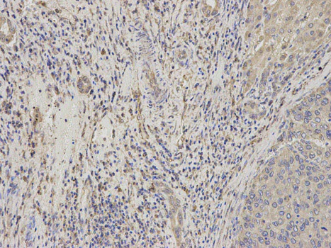 Immunohistochemistry (Formalin/PFA-fixed paraffin-embedded sections) - Anti-Niemann Pick C2 antibody (AB186829)