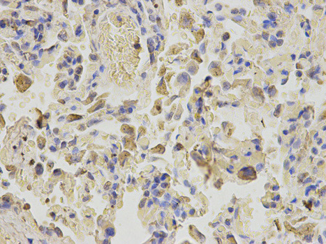 Immunohistochemistry (Formalin/PFA-fixed paraffin-embedded sections) - Anti-Niemann Pick C2 antibody (AB186829), expandable thumbnail