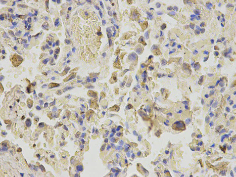 Immunohistochemistry (Formalin/PFA-fixed paraffin-embedded sections) - Anti-Niemann Pick C2 antibody (AB186829)
