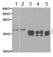 Western blot - Anti-Niemann Pick C2 antibody (AB186829), expandable thumbnail
