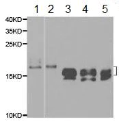 Western blot - Anti-Niemann Pick C2 antibody (AB186829)