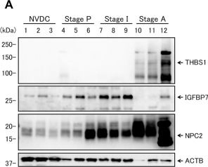 Western blot - Anti-Niemann Pick C2 antibody (ab186829), expandable thumbnail