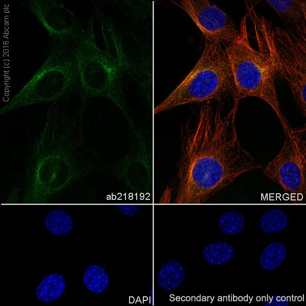 Immunocytochemistry/ Immunofluorescence - Anti-Niemann Pick C2 antibody [EPR19993-145-1] - BSA and Azide free (AB251560)