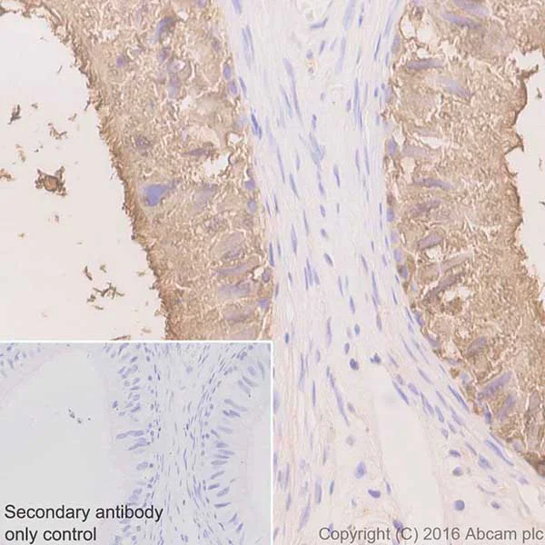 Immunohistochemistry (Formalin/PFA-fixed paraffin-embedded sections) - Anti-Niemann Pick C2 antibody [EPR19993-145-1] - BSA and Azide free (AB251560)