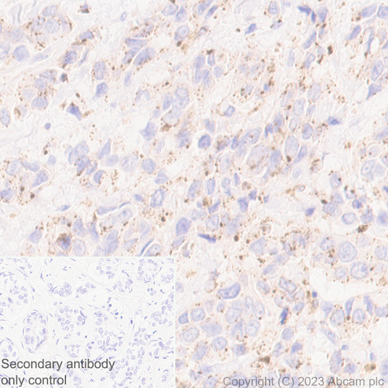 Immunohistochemistry (Formalin/PFA-fixed paraffin-embedded sections) - Anti-Niemann Pick C2 antibody [EPR19993-145-1] - BSA and Azide free (ab251560), expandable thumbnail
